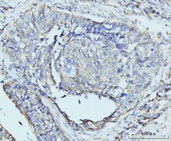 Anti-RPL23 / 60S ribosomal protein L23