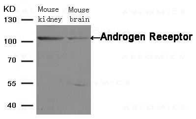 Anti-Androgen Receptor (Ab-650)