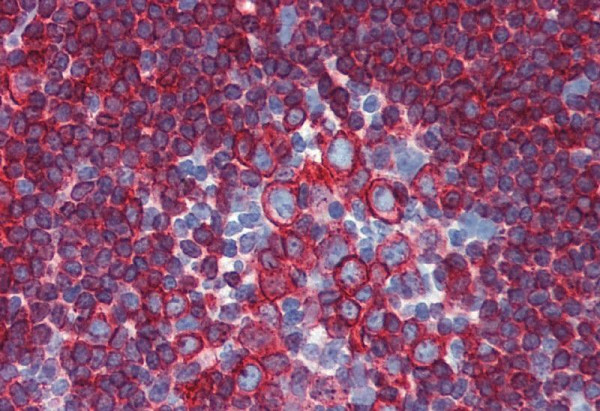 Anti-HLA-DR+DP Monoclonal Antibody (Clone:HL-40)