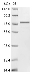 Alpha-1,3-mannosyl-glycoprotein 2-beta-N-acetylglucosaminyltransferase (GNTI), partial, Arabidopsis