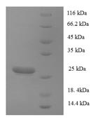 Collagen alpha-1 (XVII) chain (COL17A1), partial, human, recombinant