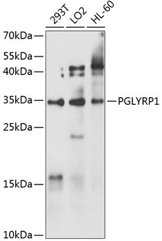 Anti-PGLYRP1