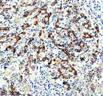 Anti-DGAT1 / Diacylglycerol O-acyltransferase 1, clone 23D11
