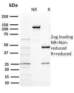 Anti-BAP1 (BRCA1 Associated Protein 1)(BAP1/2431), 1mg/mL