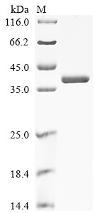 Annexin A2 (Anxa2), mouse, recombinant