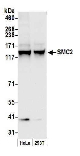 Anti-SMC2