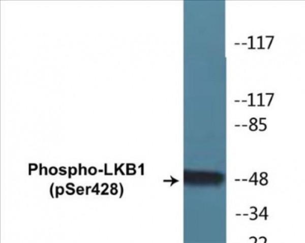 LKB1 (Phospho-Ser428) Colorimetric Cell-Based ELISA Kit