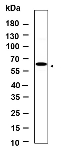 Anti-Recombinant Phospho-p70 S6 kinase beta (Ser371), clone 6H12