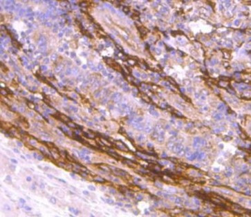 Anti-FAP / Fibroblast activation protein