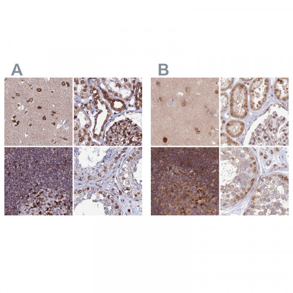Anti-TOR1AIP1