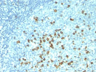 Anti-CD57 / B3GAT1 (Natural Killer Cell Marker)(HNK-1 + NK-1)