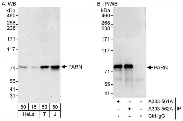 Anti-PARN