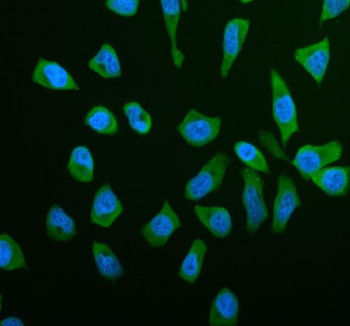 Anti-RPS21 / 40S ribosomal protein S21