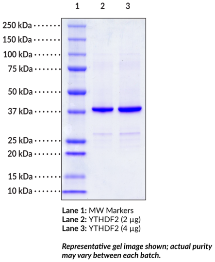 YTHDF2 (human recombinant)