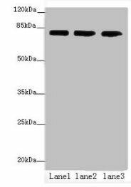 Anti-AP4B1