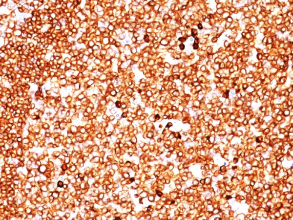 Anti-CD79a (B-Cell Marker), clone SPM549