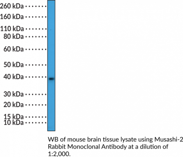Anti-Musashi-2 Rabbit Monoclonal Antibody (Clone RM422)
