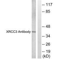 Anti-XRCC3
