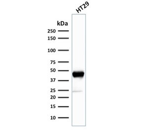 Anti-Cytokeratin 20 / CK20, clone SPM140