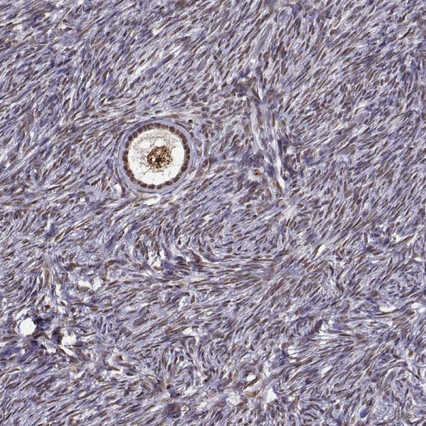 Anti-EZH1