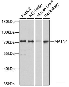 Anti-MATN4