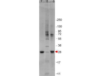 Interleukin-6 (IL-6), human recombinant (rHuIL-6)