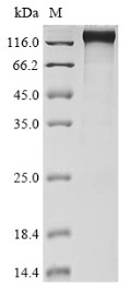 Nuclear pore complex protein Nup98-Nup96 (NUP98), partial, human, recombinant