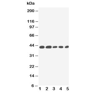 Anti-IL-2 Receptor (gamma subunit)