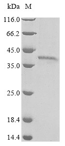 Protein Wnt-7b (WNT7B), human, recombinant