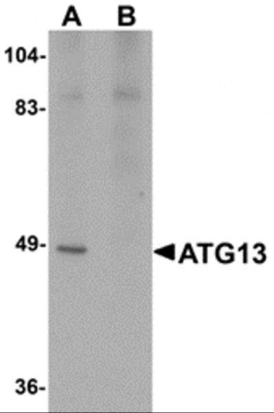 Anti-ATG13