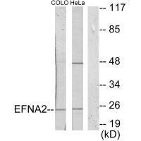 Anti-EFNA2
