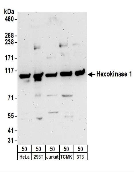 Anti-Hexokinase 1