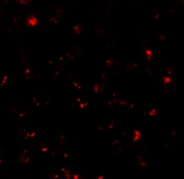 Anti-SDHD