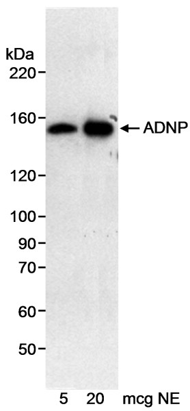 Anti-ADNP