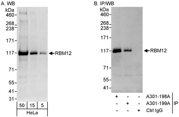 Anti-RBM12