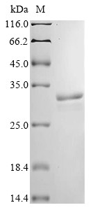 Acetoacetate decarboxylase (adc), Clostridium acetobutylicum, recombinant
