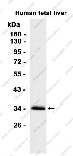 Anti-Recombinant SULT2A1/ST2, clone C113139