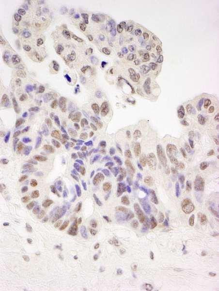Anti-Tat-SF1 (IHC)