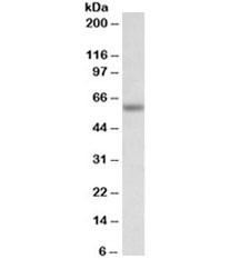 Anti-Glycine receptor