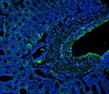 Anti-Cd146 / MCAM / MUC18