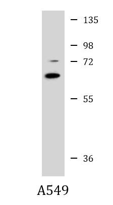 Anti-SQSTM1 / p62, clone 1336CT763.152.125