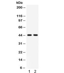 Anti-WNT3A