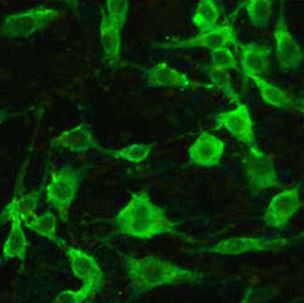 Anti-alpha 1 Antitrypsin