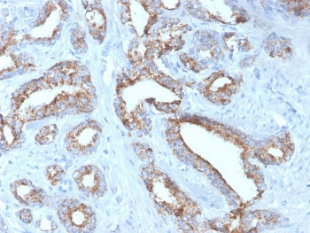 Anti-AMACR / p504S (Prostate Cancer Marker), clone rAMACR/4674