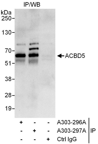 Anti-ACBD5
