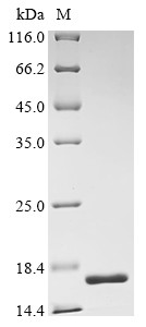 Fragile X mental retardation syndrome-related protein 1 (FXR1), partial, human, recombinant