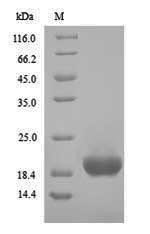 Hemagglutinin component of the neurotoxin complex (ha17), Clostridium botulinum, recombinant