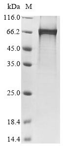 Netrin-1 (Ntn1) (X544S,X576S,X589S), rat, recombinant
