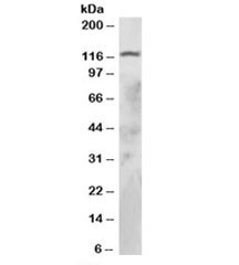 Anti-RNF31