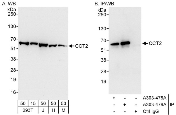 Anti-CCT2